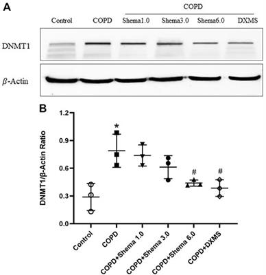 Shema Oral Liquid Ameliorates the Severity of LPS-Induced COPD via Regulating DNMT1